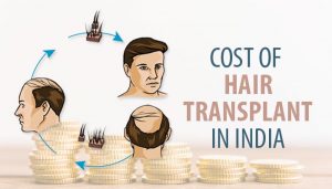 hair transplant cost